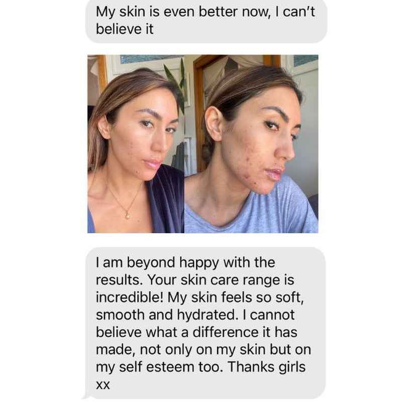 Pro-Collagen Vitamin Serum - 30Ml | Hyaluronic Acid | Vitamin C Hyaluronic Hyaluronic Acid